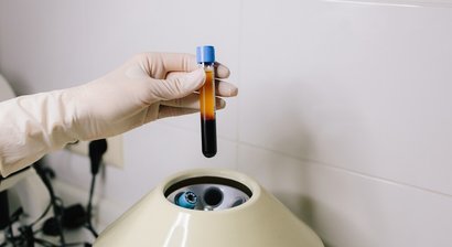 Eigenbluttherapie (PRP / ACP)