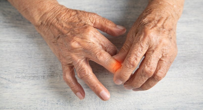 Morbus Dupuytren-Therapie bei Dr. Oliver Pieper