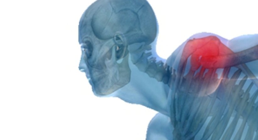 Impingement - OA Dr. Philipp Grabowiecki - Orthopäde Mödling 2340