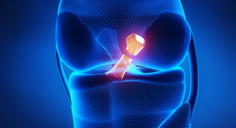 Kreuzband - OA Dr. Philipp Grabowiecki - Orthopäde Mödling 2340