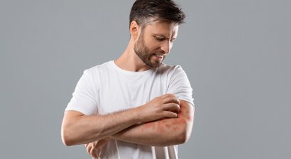 Akuter und chronischer Nesselausschlag (Urtikaria)