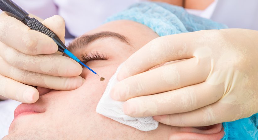 Operative Dermatologie - Dr. Sophie Hammerer - Hautärztin Wien 1010