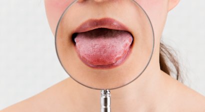 Schleimhauterkrankungen