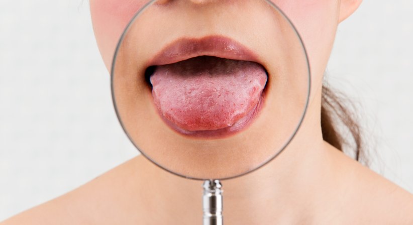 Schleimhauterkrankungen - Dr. Sophie Hammerer - Hautärztin Wien 1010