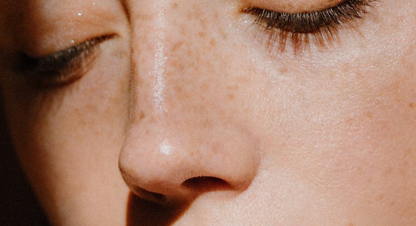 Lasertherapie - Dr. Sophie Hammerer - Hautärztin Wien 1010