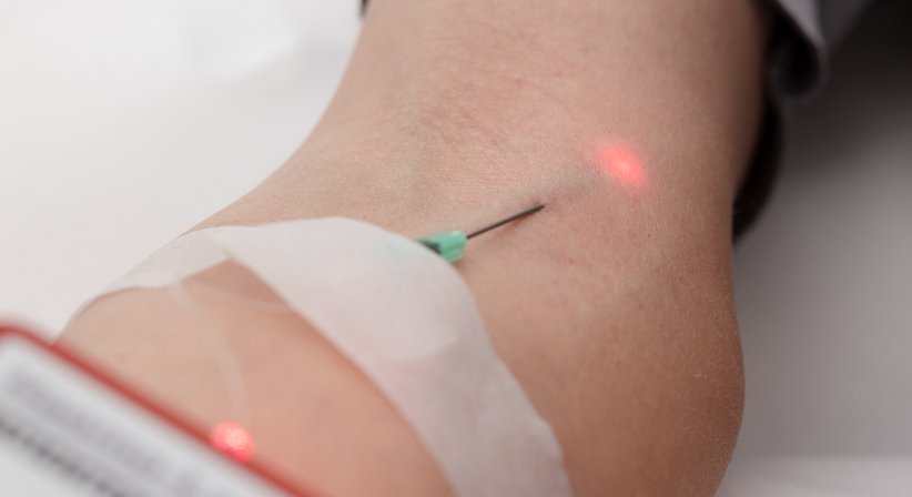 Lasertherapie - Dr. Hildegard Keil - Allgemeinmedizinerin und Familienmedizinerin Graz 8010