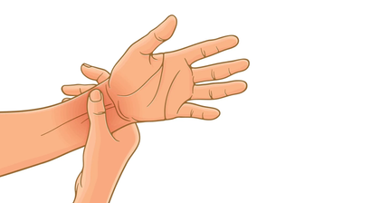 Handchirurgie: Karpaltunnelsyndrom, Schnappfinger etc.