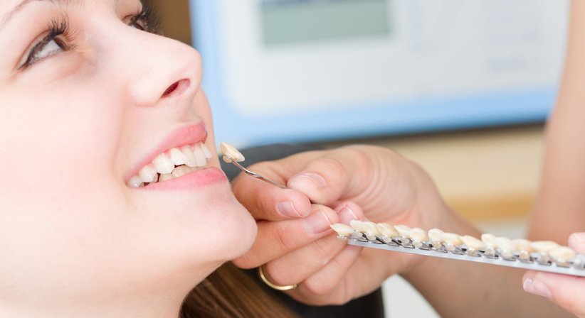 Veneers - Dr. Marius Johannes Romanin - Zahnarzt Wien 1180