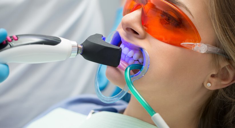 Zahnästhetik - Dr. Leon Golestani, BSc, MA, MSc - Zahnarzt Wien 1060