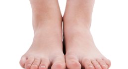 Hallux valgus -