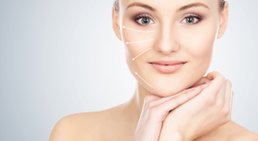 Fadenlifting -