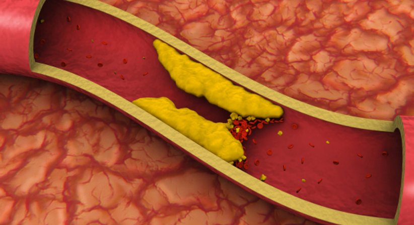 Ultraschall der Becken-Beingefäße (Sonografie der peripheren Gefäße) - Dr. Tania Fuchs, MSc. - Internistin Wien 1010