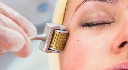 Microneedling/Medical Needling