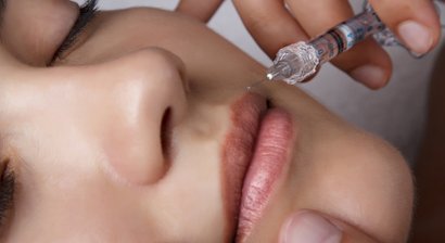 Unterspritzungen/Filler