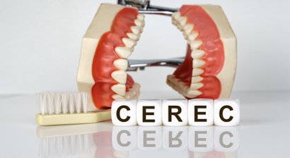 CEREC