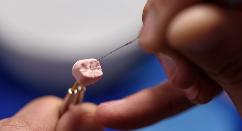 Inlays / Onlays - Dr. Theresa Mihalits - Zahnärztin Draßburg 7021