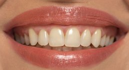 Dr. Theresa Mihalits - Zahnärztin Draßburg 7021