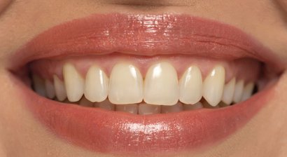 Ästhetische Korrekturen