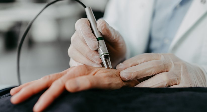 Lasertherapie - OA Dr. Matthias Karasek - Hautarzt St. Pölten 3100