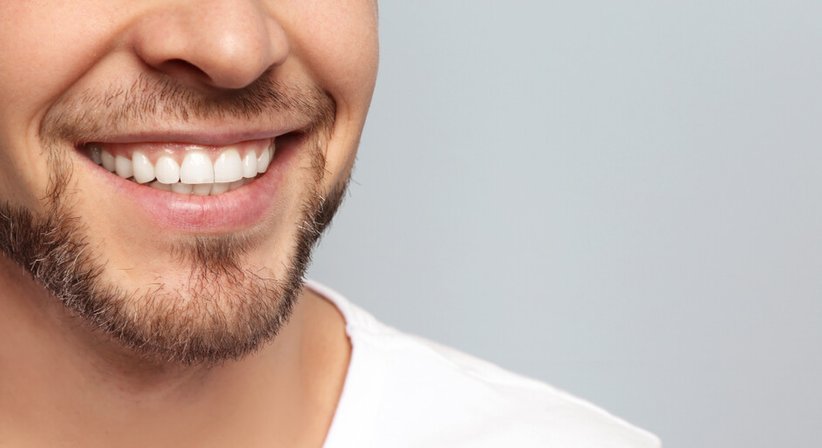 Bleaching - DDr. Julia d'Aron, MSc - Zahnärztin Wien 1190