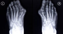 OA Dr. Heribert Salfinger - Orthopäde Wien 1180