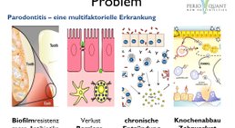 Gesundes Zahnfleisch - für Ihre Allgemeingesundheit -