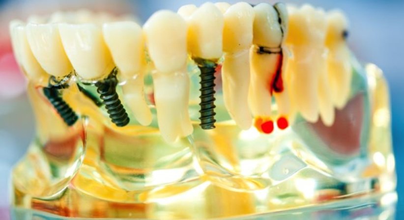 Kieferanalyse - Dr. Konrad Jacobs - Zahnarzt Wien 1010