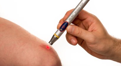 Lasertherapie (Softlaser)