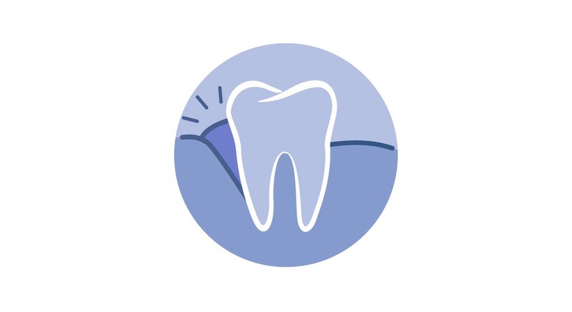 Parodontologie - DDr. Hubert Ofner - Kieferchirurg Linz 4020