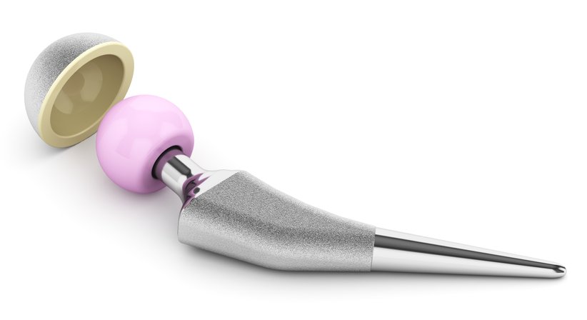 Hüftprothese - Operation - OA Dr. Lorenz Pötz - Orthopäde Wien 1060