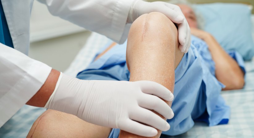 Knieprothese - Wechseloperation - OA Dr. Lorenz Pötz - Orthopäde Wien 1060