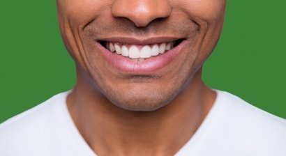 Ästhetische Zahnheilkunde