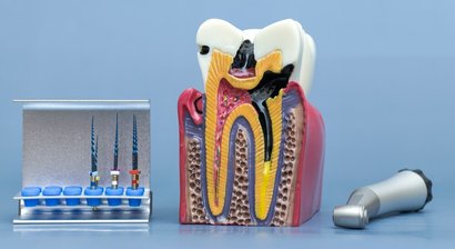 Endodontie (Wurzelkanalbehandlung)