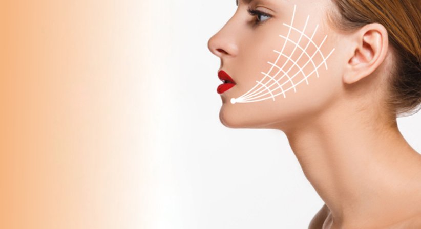 Fadenlifting - Dr. Harald Kubiena - Plastischer Chirurg Wien 1190