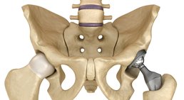 OA Dr. Markus Winnisch, MSc - Orthopäde Rauris 5661