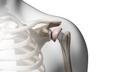 OA Dr. Markus Winnisch, MSc - Orthopäde Rauris 5661