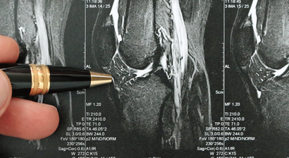Arthroskopische Eingriffe am Kniegelenk