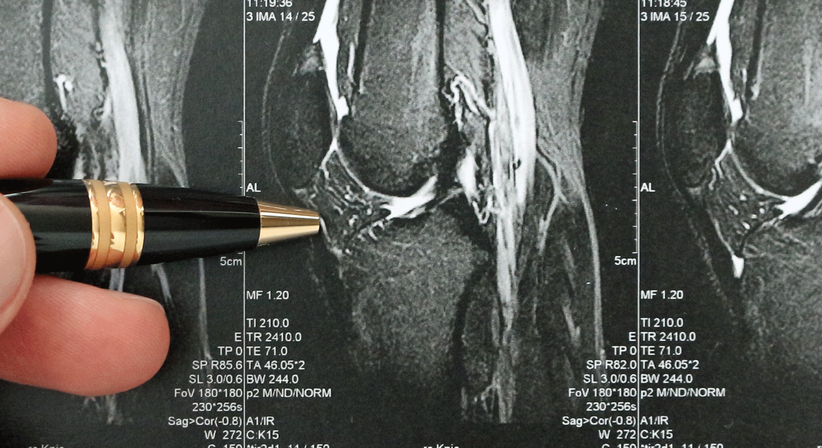 Arthroskopische Eingriffe am Kniegelenk - OA Dr. med. univ. Shady El Marto, WDM - Unfallchirurg Wien 1010