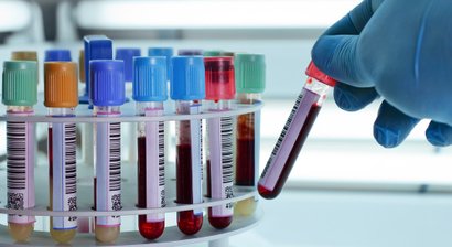 ACP - Therapie zur Behandlung von Knorpelschäden