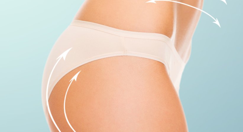 Hautstraffung nach Gewichtsabnahme (Fast Track Bodylift) - Dr. Matthias Koller - Plastischer Chirurg Puchenau 4048
