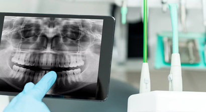 Oral- und kieferchirurgische Eingriffe