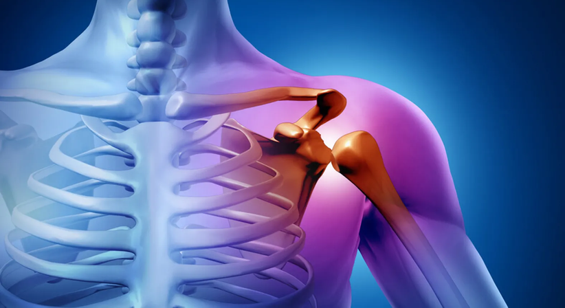 Schulterluxation - Dr. med. univ. Richard Kellner - Orthopäde Zillingdorf 2491