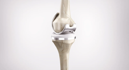 Dr. med. univ. Richard Kellner - Orthopäde Zillingdorf 2491