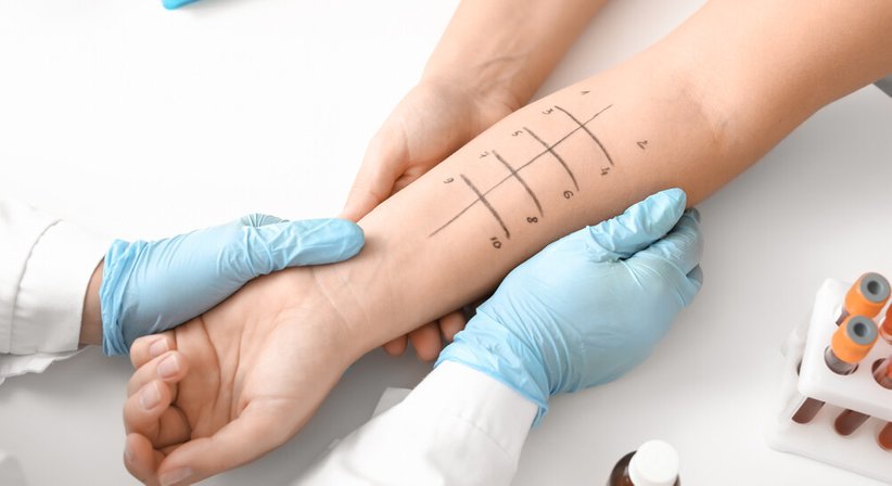 Allergien - Dr. Martin Dejaco - HNO-Arzt Salzburg 5020