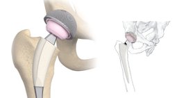Dr. Erdal Cetin - Orthopäde Wien 1110