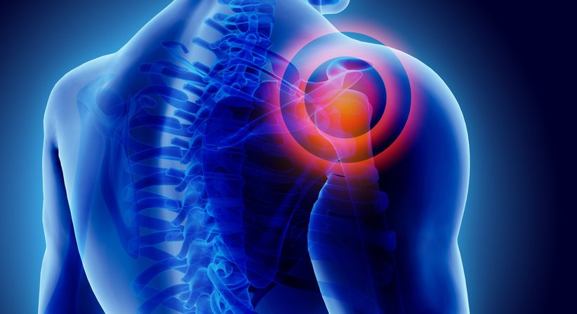  Schulteroperationen  - Dr. Erdal Cetin - Orthopäde Wien 1110