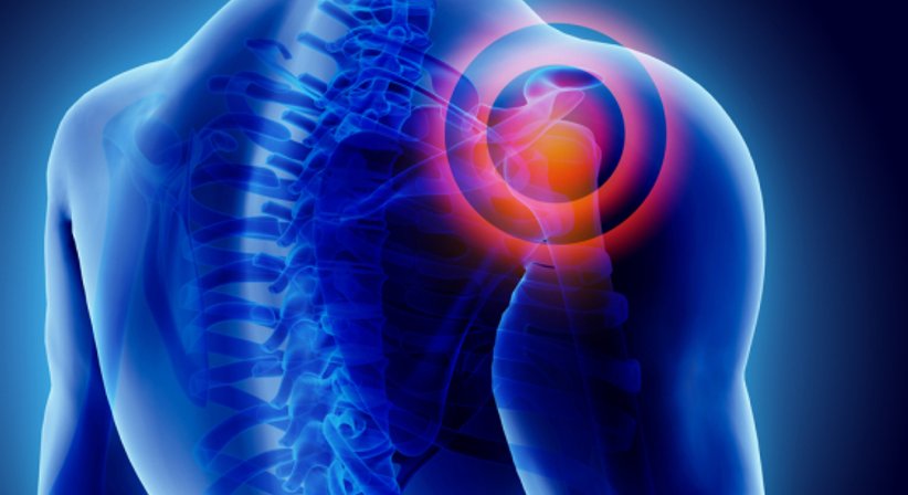 Rotatorenmanschette (Rotatorenmanschettenruptur, Impingement) - Dr. Alexander Mildner - Unfallchirurg Stockerau 2000
