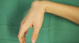 Univ.-Prof. Dr. Hugo Benito Kitzinger - Schwerpunkt: Handchirurgie Wien 1190