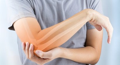 Sulcus nervi ulnaris-Syndrom (Kubitaltunnelsyndrom)