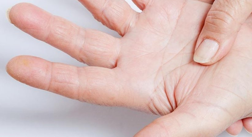 Handchirurgie - Dr. Gerhard Kainz - Orthopäde Wien 1130